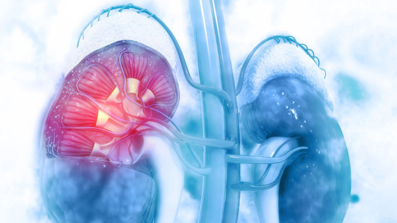Acute kidney injury treatment in Jaipur