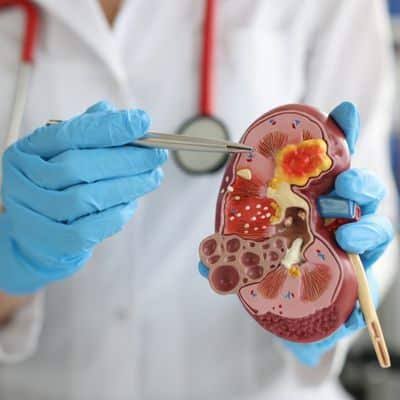 Polycystic kidney disease and renal biopsy in Jaipur