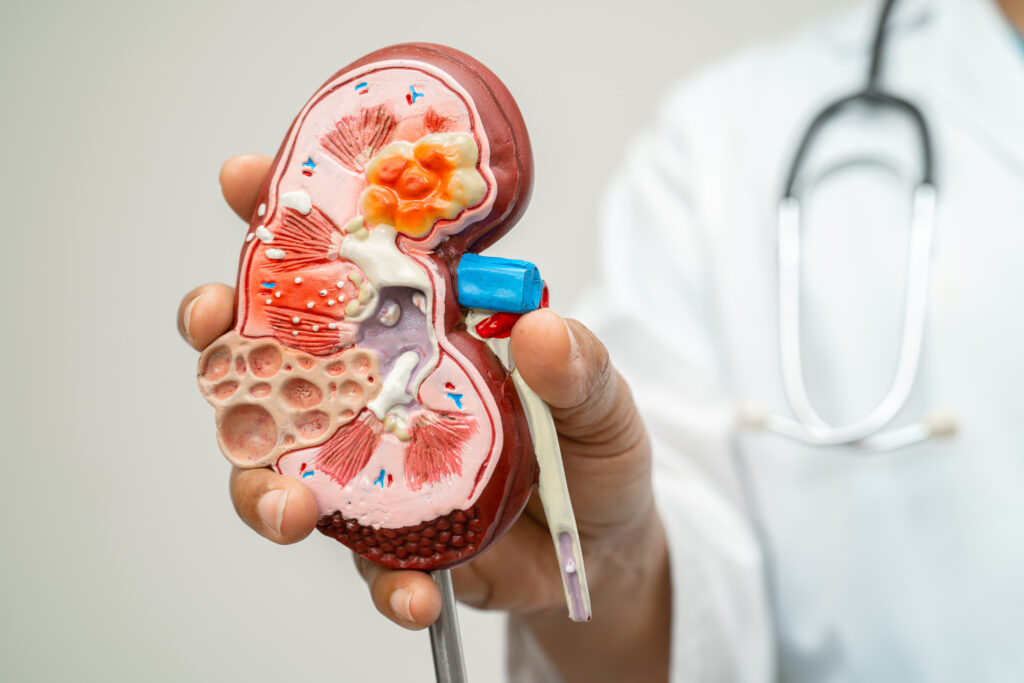 Chronic Kidney Disease (CKD) treatment