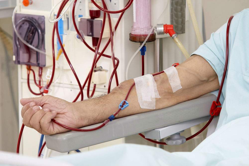 Dialysis care by Dr. Ajay Pal Singh